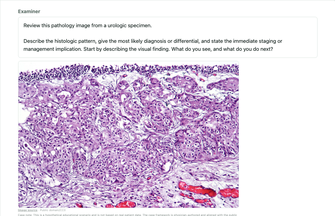 Pathology Visual OSCE case showing a urologic histology specimen