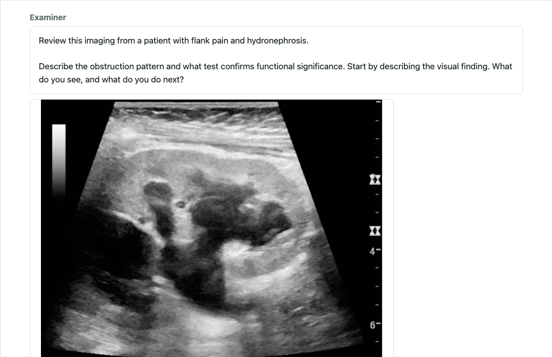 Radiology Visual OSCE case showing hydronephrosis on ultrasound